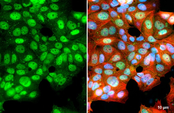 KDM6A Antibody (HL1731) - Azide and BSA Free