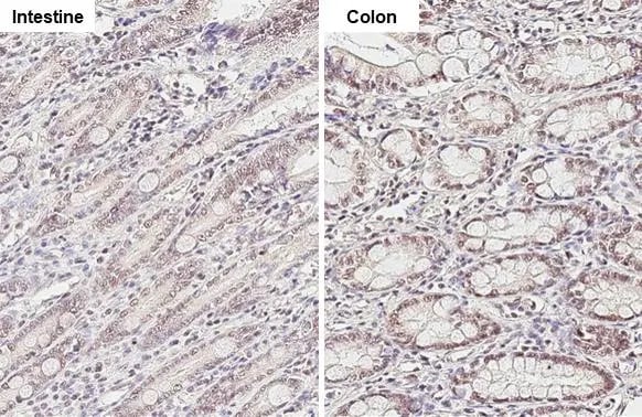 KDM6A Antibody (HL1731) - Azide and BSA Free
