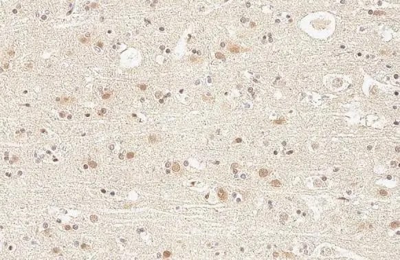 KDM6A Antibody (HL1731) - Azide and BSA Free