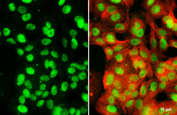 KDM6A Antibody (HL2068) - Azide and BSA Free