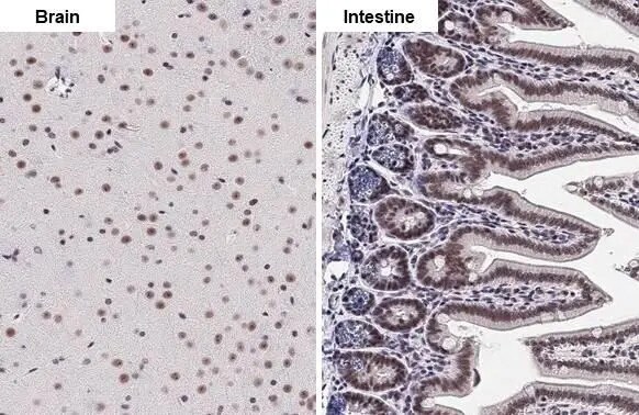 KDM6A Antibody (HL2068) - Azide and BSA Free