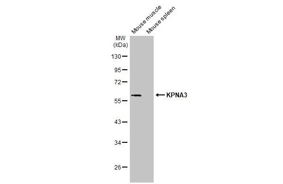 KPNA3 Antibody (HL1573) - Azide and BSA Free