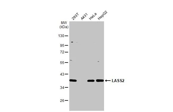 LASS2 Antibody (HL1717) - Azide and BSA Free