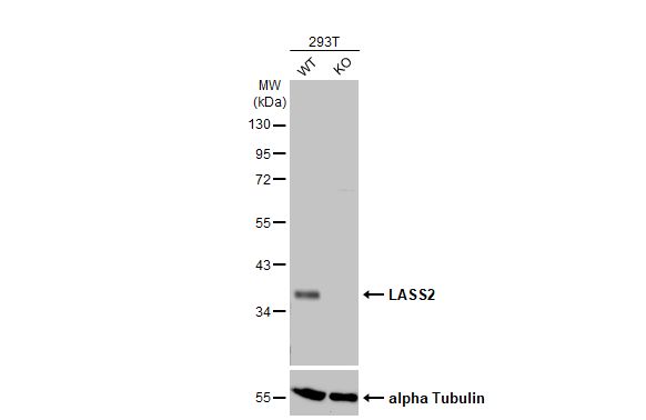 LASS2 Antibody (HL1717) - Azide and BSA Free