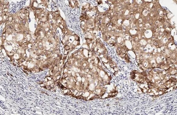 LASS2 Antibody (HL1717) - Azide and BSA Free