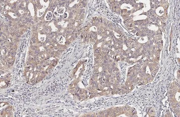 LASS2 Antibody (HL1717) - Azide and BSA Free