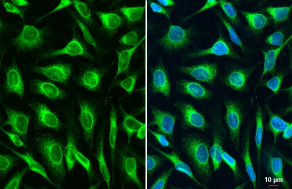 LASS2 Antibody (HL1717) - Azide and BSA Free