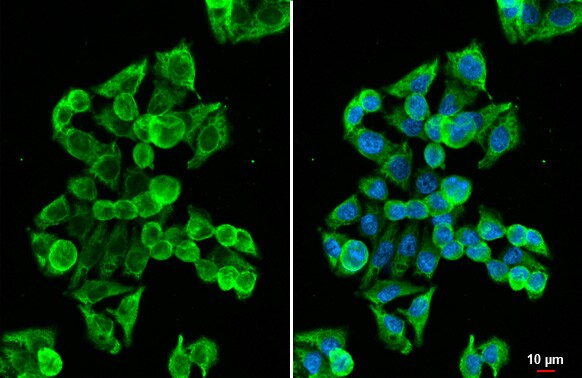 Melanocortin-1 R/MC1R Antibody (HL1471) - Azide and BSA Free