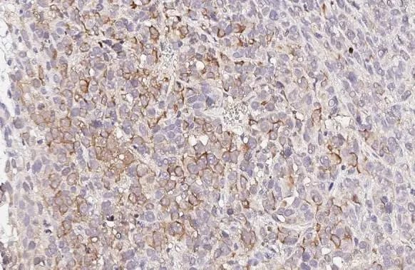 Melanocortin-1 R/MC1R Antibody (HL1471) - Azide and BSA Free