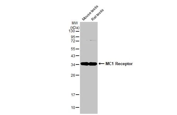 Melanocortin-1 R/MC1R Antibody (HL1471) - Azide and BSA Free