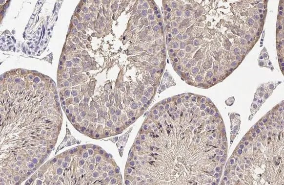 Melanocortin-1 R/MC1R Antibody (HL1471) - Azide and BSA Free