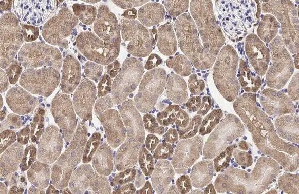 Melanocortin-1 R/MC1R Antibody (HL1471) - Azide and BSA Free