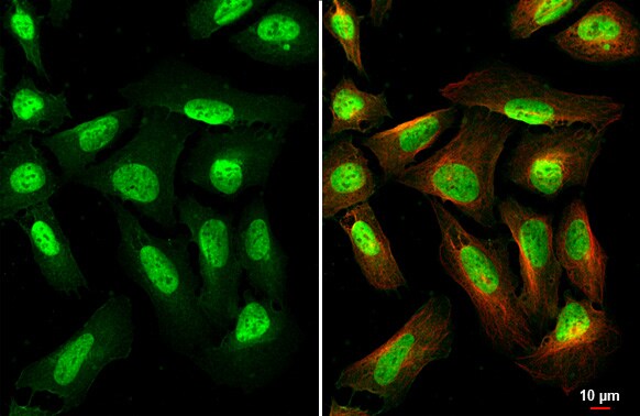 METTL14 Antibody (HL1816) - Azide and BSA Free
