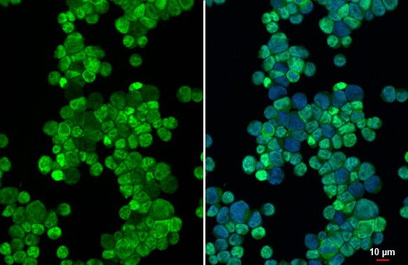 METTL14 Antibody (HL1816) - Azide and BSA Free