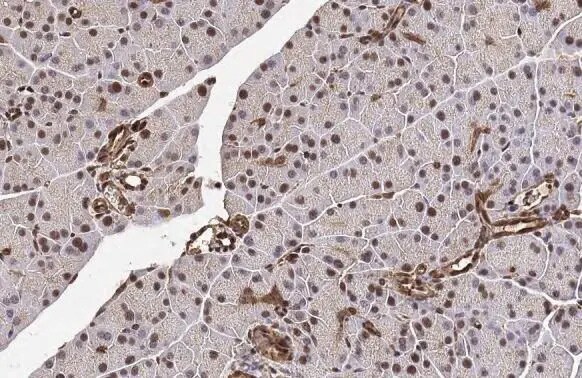 METTL14 Antibody (HL1816) - Azide and BSA Free