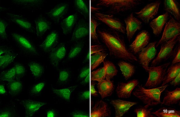 Miz-1/ZBTB17 Antibody (HL1548) - Azide and BSA Free
