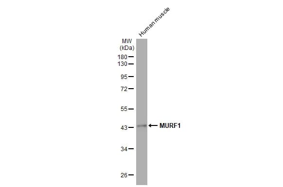 MuRF1/TRIM63 Antibody (HL1450) - Azide and BSA Free
