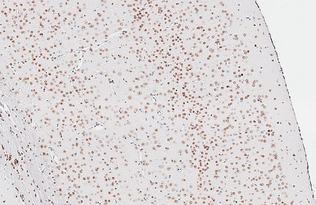 NFIX Antibody (HL1269) - Azide and BSA Free