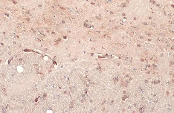 NUP62 Antibody (HL1226) - Azide and BSA Free