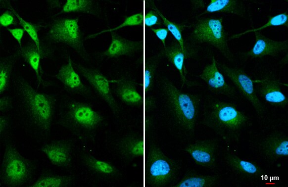 O-GlcNAc Transferase p110 subunit Antibody (HL1641) - Azide and BSA Free