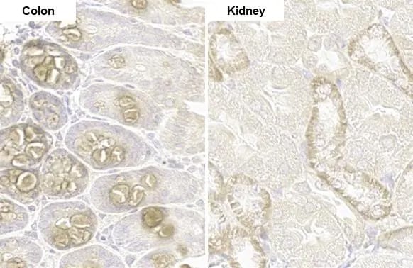 PARP14 Antibody (HL1178) - Azide and BSA Free