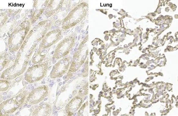 PARP14 Antibody (HL1180) - Azide and BSA Free