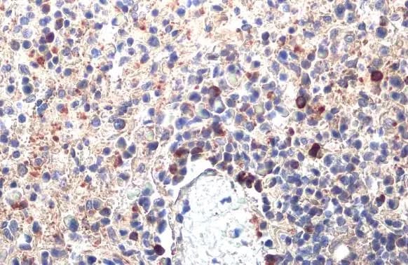 PARP14 Antibody (HL1180) - Azide and BSA Free