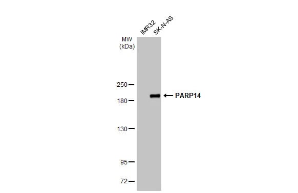 PARP14 Antibody (HL1180) - Azide and BSA Free