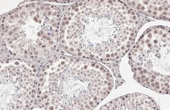 BRPF1 Antibody (HL2064) - Azide and BSA Free