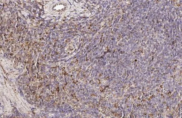 PFKFB4 Antibody (HL2204) - Azide and BSA Free