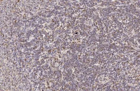 PFKFB4 Antibody (HL2204) - Azide and BSA Free