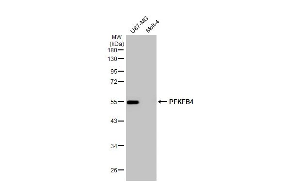 PFKFB4 Antibody (HL2204) - Azide and BSA Free