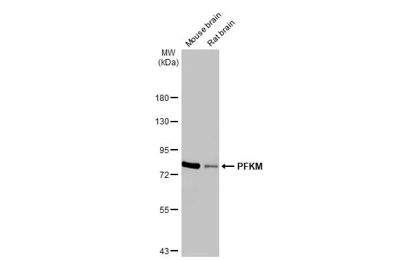Muscle Phosphofructokinase/PFKM/PFK-1 Antibody (HL2010) - Azide and BSA Free