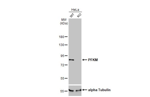 Muscle Phosphofructokinase/PFKM/PFK-1 Antibody (HL2010) - Azide and BSA Free