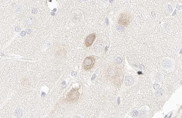 PIK3C2A Antibody (HL1612) - Azide and BSA Free