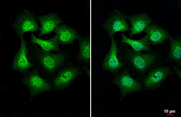 PIP5K1 alpha Antibody (HL2011) - Azide and BSA Free