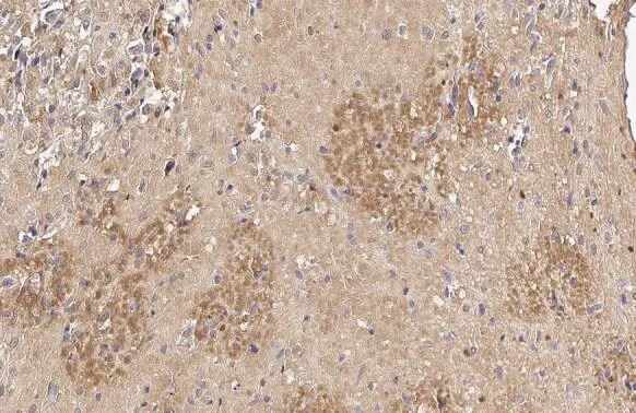 PIP5K1 alpha Antibody (HL2011) - Azide and BSA Free
