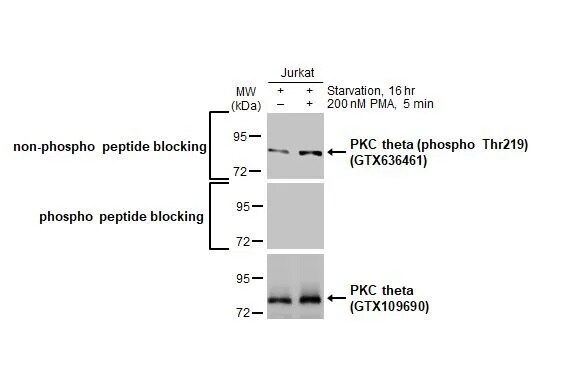 PKC theta [p Thr219] Antibody (HL1157) - Azide and BSA Free
