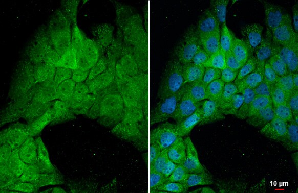PP2A alpha Antibody (HL1447) - Azide and BSA Free