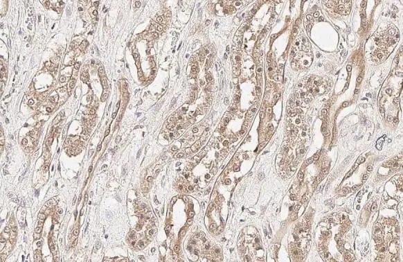 PP2A alpha Antibody (HL1447) - Azide and BSA Free