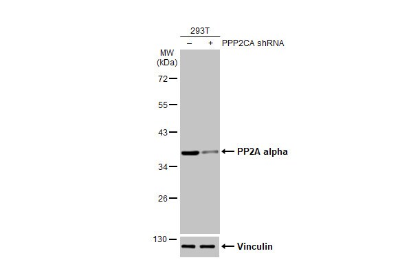 PP2A alpha Antibody (HL1447) - Azide and BSA Free