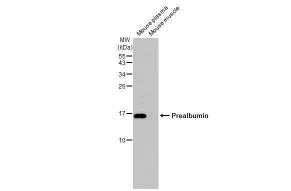 Transthyretin/Prealbumin Antibody (HL1823) - Azide and BSA Free