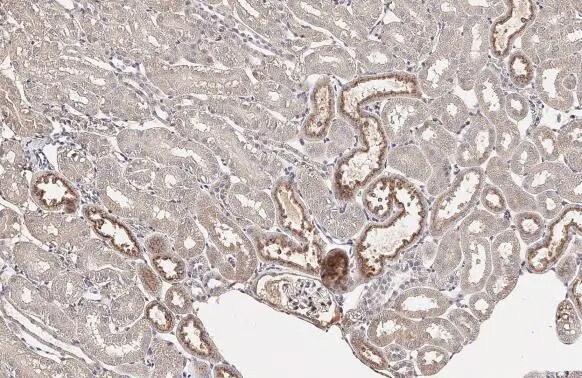 Transthyretin/Prealbumin Antibody (HL1823) - Azide and BSA Free