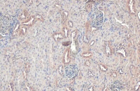 Rab5a Antibody (HL1497) - Azide and BSA Free