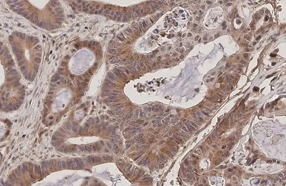 RanBP1 Antibody (HL2358) - Azide and BSA Free