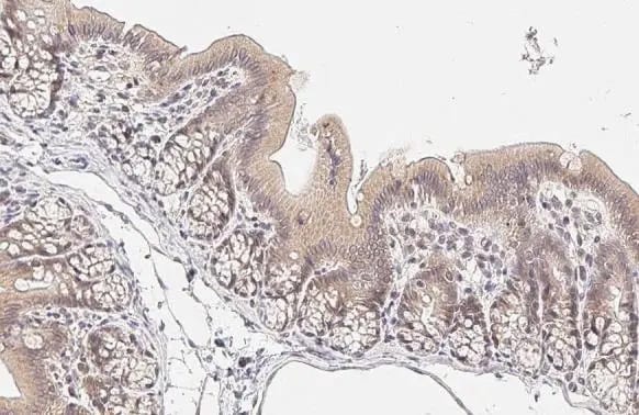 RelB Antibody (HL2222) - Azide and BSA Free