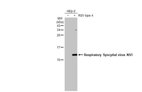 Respiratory Syncytial Virus NS1 Antibody (HL2383) - Azide and BSA Free