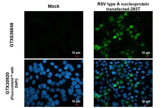 Respiratory Syncytial Virus Nucleoprotein Antibody (HL1246) - Azide and BSA Free