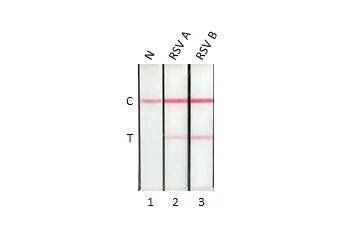 Respiratory Syncytial Virus Nucleoprotein Antibody (HL1247) - Azide and BSA Free