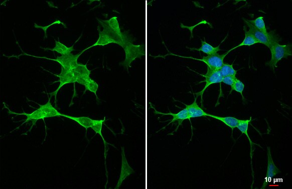 RGS4 Antibody (HL1522) - Azide and BSA Free